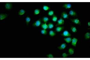 Immunofluorescence staining of A549 cells with ABIN7145207 at 1:266, counter-stained with DAPI. (Survivin 抗体  (AA 1-130))