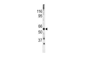 The anti-Phospho-CDC25A- Pab (ABIN389529 and ABIN2839577) is used in Western blot to detect Phospho-CDC25A- in mouse heart tissue lysate (CDC25A 抗体  (pSer278))