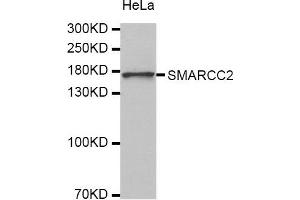 Western Blotting (WB) image for anti-SWI/SNF Related, Matrix Associated, Actin Dependent Regulator of Chromatin, Subfamily C, Member 2 (SMARCC2) antibody (ABIN1874865) (SMARCC2 抗体)