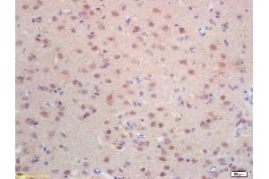 Formalin-fixed and paraffin embedded rat brain labeled with Rabbit Anti Histone H3-like protein Polyclonal Antibody, Unconjugated (ABIN670986) at 1:200 followed by conjugation to the secondary antibody and DAB staining (Centromeric Histone H3-Like Protein-2 (AA 51-145) 抗体)