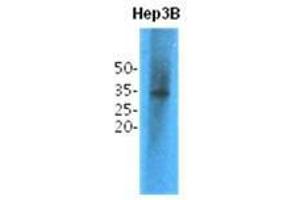 Western Blotting (WB) image for anti-Thiopurine S-Methyltransferase (TPMT) antibody (ABIN781550) (TPMT 抗体)
