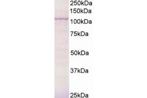 Western Blotting (WB) image for anti-Breast Cancer Anti-Estrogen Resistance 3 (BCAR3) (C-Term) antibody (ABIN2465465) (BCAR3 抗体  (C-Term))