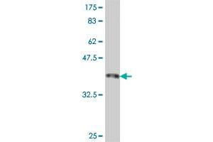 Western Blot detection against Immunogen (37. (SMC1A 抗体  (AA 366-465))