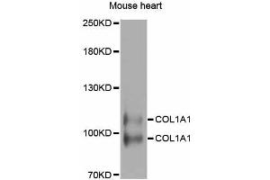 Western blot analysis of extracts of mouse heart, using COL1A1 antibody (ABIN5997480) at 1/1000 dilution. (COL1A1 抗体)