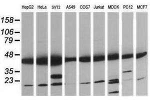 Image no. 8 for anti-Mitogen-Activated Protein Kinase Kinase 1 (MAP2K1) antibody (ABIN1499385) (MEK1 抗体)
