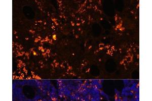 Immunofluorescence analysis of Rat bone marrow cells using GPR55 Polyclonal Antibody at dilution of 1:100. (GPR55 抗体)