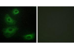 Peptide - +Immunohistochemistry analysis of paraffin-embedded human brain tissue, using 5-HT-1B antibody. (5HT1B Receptor 抗体  (Internal Region))