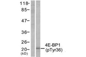 Western Blotting (WB) image for anti-Eukaryotic Translation Initiation Factor 4E Binding Protein 1 (EIF4EBP1) (pThr36) antibody (ABIN2888349) (eIF4EBP1 抗体  (pThr36))