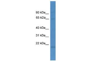 WB Suggested Anti-LTA4H Antibody Titration: 0. (LTA4H 抗体  (N-Term))