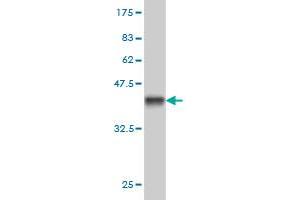 Western Blotting (WB) image for anti-Sorbitol Dehydrogenase (SORD) (AA 1-110) antibody (ABIN562952)