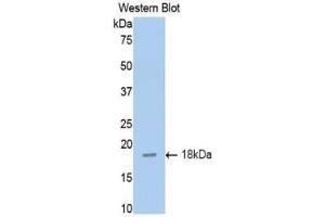 Western blot analysis of the recombinant protein. (TNFRSF10B 抗体  (AA 54-180))