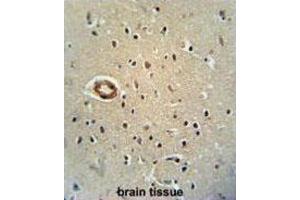 Immunohistochemistry (IHC) image for anti-CWC22 Spliceosome-Associated Protein Homolog (CWC22) antibody (ABIN2995841) (CWC22 抗体)