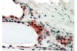 Immunohistochemistry (IHC) image for anti-Casein beta (CSN2) antibody (ABIN5859099) (CSN2 抗体)