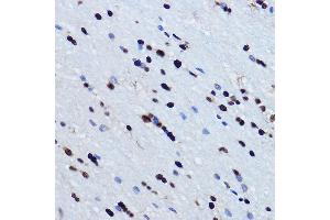 Immunohistochemistry of paraffin-embedded mouse brain using TDP-43/TARDB Rabbit pAb  at dilution of 1:500 (40x lens). (TARDBP 抗体  (AA 1-100))