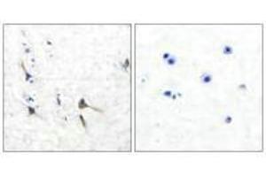 Immunohistochemical analysis of paraffin-embedded human brain tissue using Potassium Channel Kv3. (KCNC2 抗体)