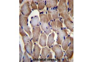 Immunohistochemistry (IHC) image for anti-Selenoprotein N, 1 (SEPN1) antibody (ABIN2996755) (SEPN1 抗体)