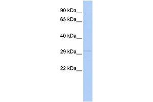 WB Suggested Anti-LYPD4 Antibody Titration: 0. (LYPD4 抗体  (N-Term))