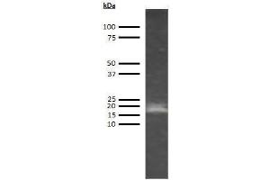 Western Blotting (WB) image for anti-Adiponectin (ADIPOQ) antibody (ABIN613395) (ADIPOQ 抗体)