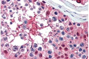 Human Testis (formalin-fixed, paraffin-embedded) stained with Ubiquitin antibody ABIN462097 at 10 ug/ml followed by biotinylated goat anti-rabbit IgG secondary antibody ABIN481713, alkaline phosphatase-streptavidin and chromogen. (Ubiquitin 抗体)