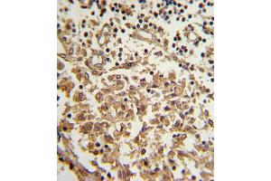 Immunohistochemistry (IHC) image for anti-Telomerase Reverse Transcriptase (TERT) antibody (ABIN2997736) (TERT 抗体)