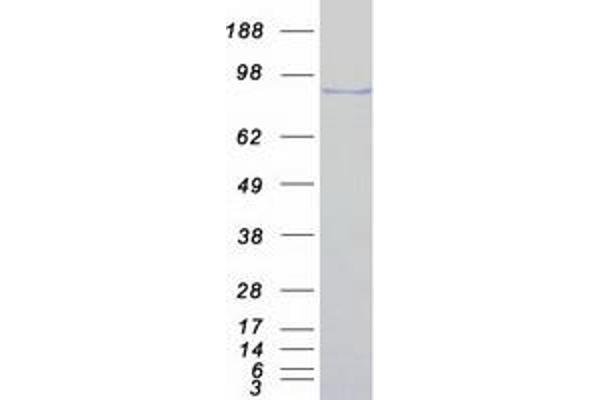 MED15 Protein (Transcript Variant 2) (Myc-DYKDDDDK Tag)