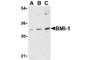 Image no. 1 for anti-BMI1 Polycomb Ring Finger Oncogene (BMI1) (Internal Region) antibody (ABIN200102) (BMI1 抗体  (Internal Region))