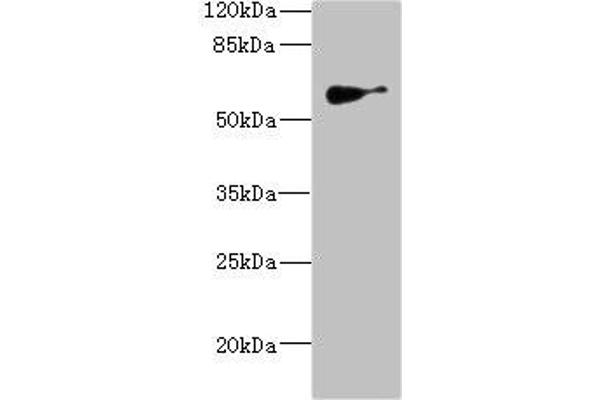 SLC22A8 抗体  (AA 473-542)
