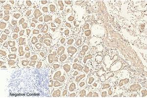 Immunohistochemical analysis of paraffin-embedded human stomach tissue. (CD4 抗体)