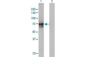 Western Blot analysis of ACOX2 expression in transfected 293T cell line by ACOX2 monoclonal antibody (M01), clone 1D1. (Acox2 抗体  (AA 582-681))