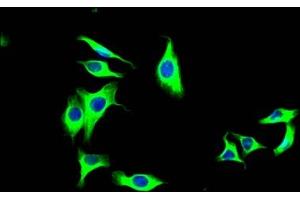 Immunofluorescence (IF) image for anti-Lysyl Oxidase-Like 2 (LOXL2) antibody (ABIN7127602)