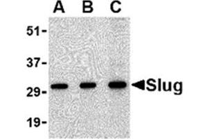 Image no. 1 for anti-Snail Family Zinc Finger 2 (SNAI2) (Middle Region) antibody (ABIN318763) (SLUG 抗体  (Middle Region))