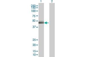 Western Blotting (WB) image for TYR 293T Cell Transient Overexpression Lysate(Denatured) (ABIN1333828)