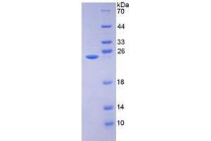 SDS-PAGE analysis of AMBP Protein. (AMBP 蛋白)