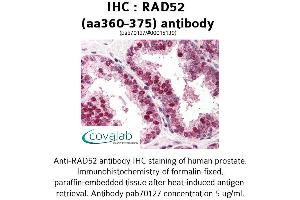 Image no. 1 for anti-RAD52 Homolog (S. Cerevisiae) (RAD52) (AA 360-375) antibody (ABIN1738702) (RAD52 抗体  (AA 360-375))