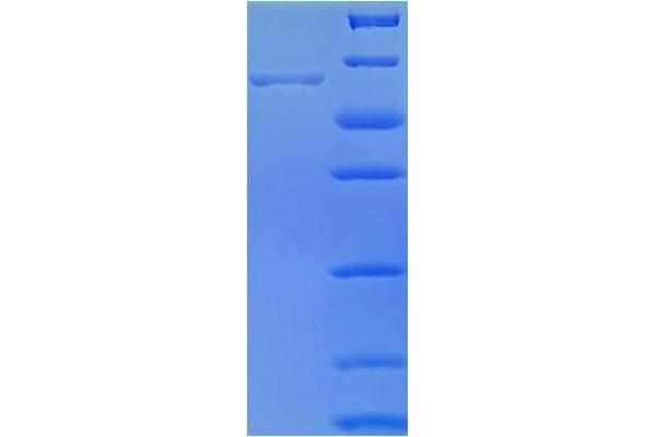 SUCLG2 Protein (AA 49-423, partial) (His-SUMO Tag)