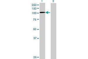 Lane 1: CXorf20 transfected lysate ( 88 KDa) Lane 2: Non-transfected lysate. (CXorf20 293T Cell Transient Overexpression Lysate(Denatured))