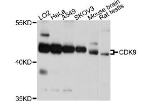Western blot analysis of extracts of various cell lines, using CDK9 antibody (ABIN5995939) at 1/1000 dilution. (CDK9 抗体)
