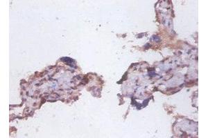 Immunohistochemistry of paraffin-embedded human placenta tissue using ABIN7173891 at dilution of 1:100 (FAS 抗体  (AA 26-171))