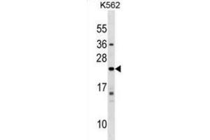 Western Blotting (WB) image for anti-Interferon, alpha 10 (IFNa10) antibody (ABIN2999555) (IFNA10 抗体)