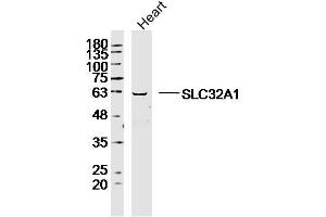 Mouse heart lysates probed with SLC32A1 Polyclonal Antibody, Unconjugated  at 1:300 dilution and 4˚C overnight incubation. (SLC32A1 抗体  (AA 351-450))
