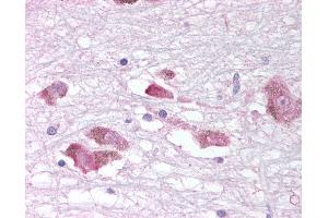 Anti-MCHR1 antibody IHC of human brain, substantia nigra. (MCHR1 抗体  (C-Term))