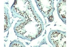 Immunohistochemistry (Formalin-fixed Paraffin-embedded Sections) (IHC (fp)) image for anti-Nucleolin (NCL) antibody (ABIN3025709)