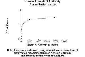 Image no. 2 for anti-Annexin A5 (ANXA5) (AA 1-320) antibody (ABIN5564834) (Annexin V 抗体  (AA 1-320))