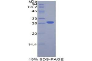 SDS-PAGE analysis of Mouse FGFRL1 Protein. (FGFRL1 蛋白)