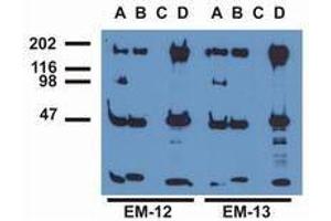 Western Blotting (WB) image for anti-Epidermal Growth Factor Receptor (EGFR) (pTyr1016) antibody (ABIN400878) (EGFR 抗体  (pTyr1016))