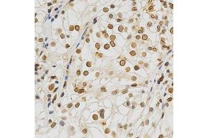 Immunohistochemistry (Paraffin-embedded Sections) (IHC (p)) image for anti-Lamin A/C (LMNA) (AA 403-572) antibody (ABIN3020785)