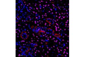 Immunofluorescence of paraffin embedded rat kidney using pax2 (ABIN7074974) at dilution of 1:600 (350x lens) (PAX2A 抗体)