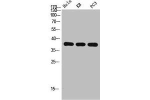Western Blot analysis of HELA KB PC-3 using p38 Polyclonal Antibody. (MAPK14 抗体  (C-Term))