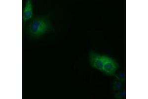 Anti-SDR9C7 mouse monoclonal antibody (ABIN2453629) immunofluorescent staining of COS7 cells transiently transfected by pCMV6-ENTRY SDR9C7 (RC210941). (SDR9C7 抗体)