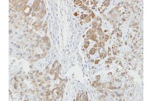 IHC-P Image Immunohistochemical analysis of paraffin-embedded A549 xenograft, using AHA-1, antibody at 1:100 dilution. (AHSA1 抗体  (Center))
